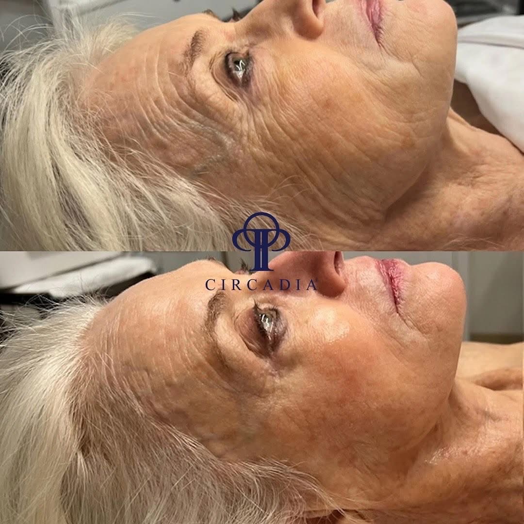 Circadia Treatments & Home Protocoll